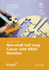 Buchcover Fast Facts for Patients: Non-small Cell Lung Cancer with KRAS Mutation
