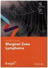 Buchcover Fast Facts for Patients: Marginal Zone Lymphoma