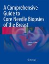 Buchcover A Comprehensive Guide to Core Needle Biopsies of the Breast