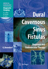 Buchcover Dural Cavernous Sinus Fistulas