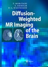 Buchcover Diffusion-Weighted MR Imaging of the Brain
