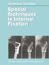 Buchcover Special Techniques in Internal Fixation