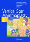 Buchcover Vertical Scar Mammaplasty