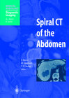 Buchcover Spiral CT of the Abdomen