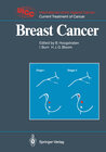 Buchcover Breast Cancer