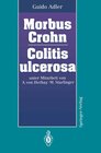 Buchcover Morbus Crohn Colitis ulcerosa