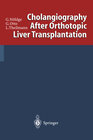 Buchcover Cholangiography After Orthotopic Liver Transplantation