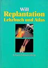 Buchcover Replantation