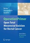 Buchcover Open total mesorectal (TME) for cancer