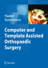 Buchcover Computer and Template Assisted Orthopedic Surgery