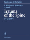 Buchcover Trauma of the Spine