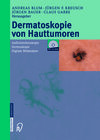 Buchcover Dermatoskopie von Hauttumoren