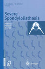 Buchcover Severe Spondylolisthesis