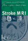 Buchcover Stroke MRI