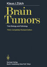 Buchcover Brain Tumors