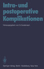 Buchcover Intra- und postoperative Komplikationen