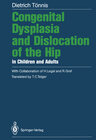 Buchcover Congenital Dysplasia and Dislocation of the Hip in Children and Adults