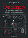 Buchcover Eye Surgery