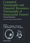 Buchcover Computed Tomography and Magnetic Resonance Tomography of Intracranial Tumors