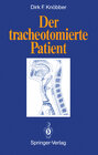 Buchcover Der tracheotomierte Patient