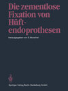 Buchcover Die zementlose Fixation von Hüftendoprothesen