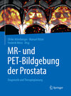 Buchcover MR- und PET-Bildgebung der Prostata