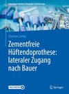 Buchcover Zementfreie Hüftendoprothese: lateraler Zugang nach Bauer