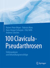Buchcover 100 Clavicula-Pseudarthrosen