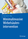 Buchcover Minimalinvasive Wirbelsäulenintervention