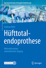 Buchcover Hüfttotalendoprothese: minimalinvasiver anterolateraler Zugang