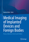 Buchcover Medical Imaging of Implanted Devices and Foreign Bodies
