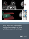 Buchcover Image registration between MRI and spot mammograms for X-ray guided stereotactic breast biopsy