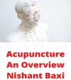 Buchcover Acupuncture An Overview