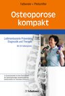 Buchcover Osteoporose kompakt