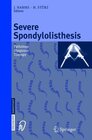 Buchcover Severe Spondylolisthesis