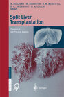 Buchcover Split liver transplantation