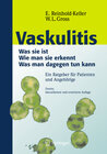 Buchcover Vaskulitis