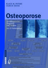Buchcover Osteoporose