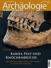 Buchcover Karies, Pest und Knochenbrüche