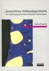 Buchcover Zementfreie Hüftendoprothetik mit Hydroxylapatit-beschichteten Implantaten