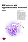 Buchcover Erkrankungen von Hypothalamus und Hypophyse