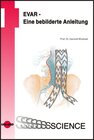 Buchcover EVAR - Eine bebilderte Anleitung / UNI-MED Science