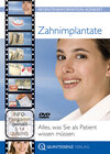 Buchcover Zahnimplantate