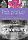 Buchcover Bisphosphonat-induzierte Osteonekrose der Kiefer