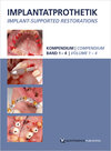 Buchcover Implantatprothetik. DVD-Kompendium