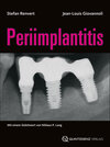 Buchcover Periimplantitis