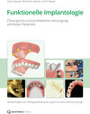 Buchcover Funktionelle Implantologie