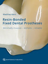 Buchcover Resin-Bonded Fixed Dental Prostheses