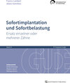 Buchcover Sofortimplantation und Sofortbelastung