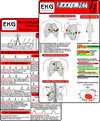 Buchcover EKG Basic Set (2er Set) - Herzrhythmusstörungen, EKG Auswertung - Medizinische Taschen-Karte